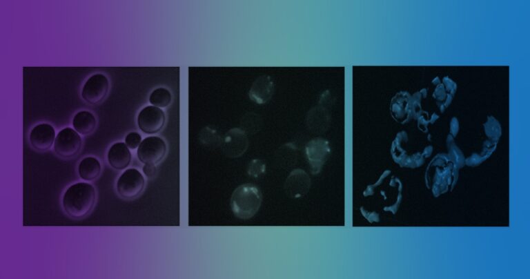 Estudiar las levaduras para entender la enfermedad de Alzheimer